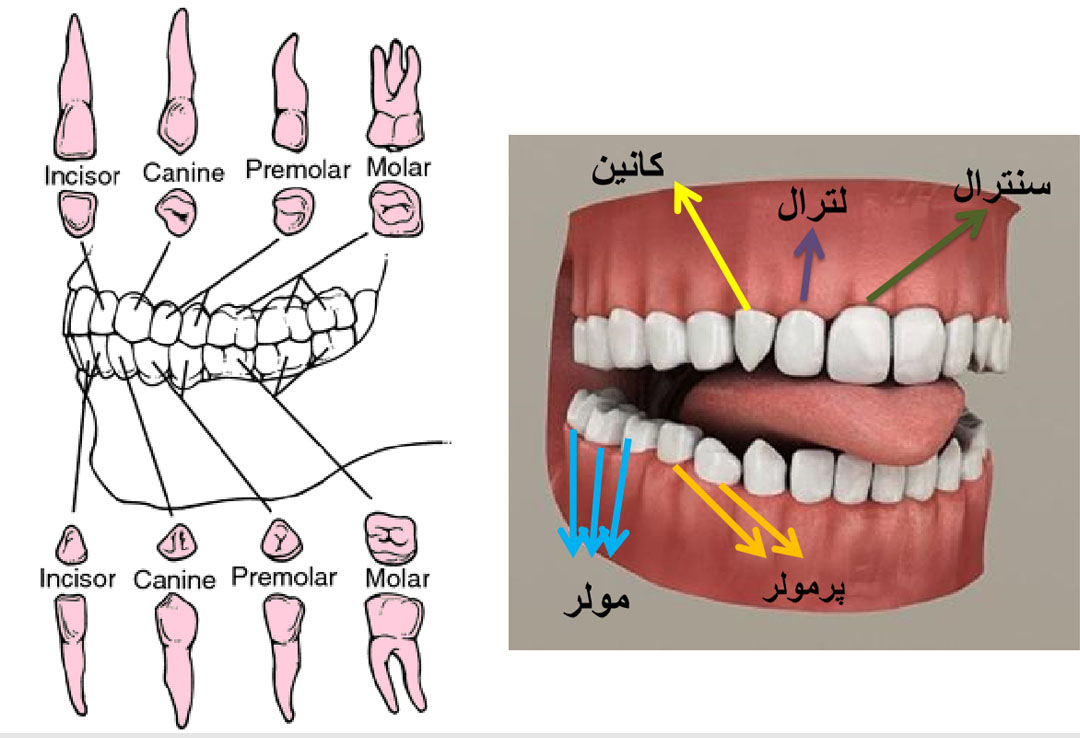 اصطلاحات دندانپزشکی ترمیمی