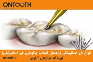 تنواع فرز های دندانپزشکی