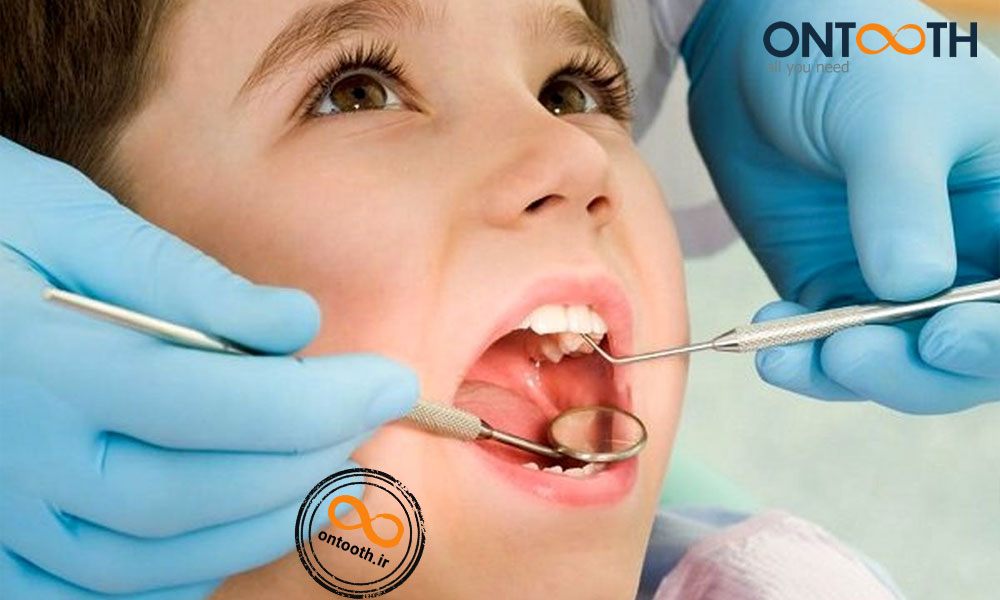دلیل پوسیدگی و درد دندان کودکان