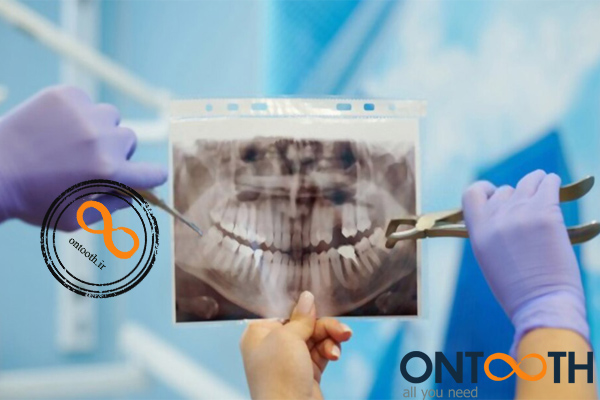 لیست تجهیزات وسایل رادیولوژی دندانپزشکی